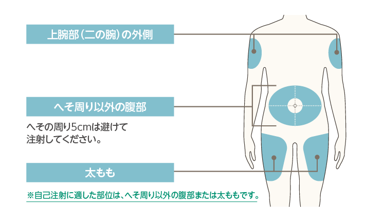 へそ周り5cmは避けて注射してください。自己注射に適した部位はへそ周り以外の腹部または太ももです